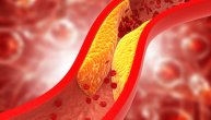 Hrana koja „čisti“ zapušene arterije i smanjuje rizik od ateroskleroze