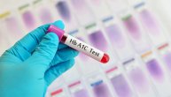Šta nam pokazuju rezultati testa hemoglobina A1c (HbA1c)