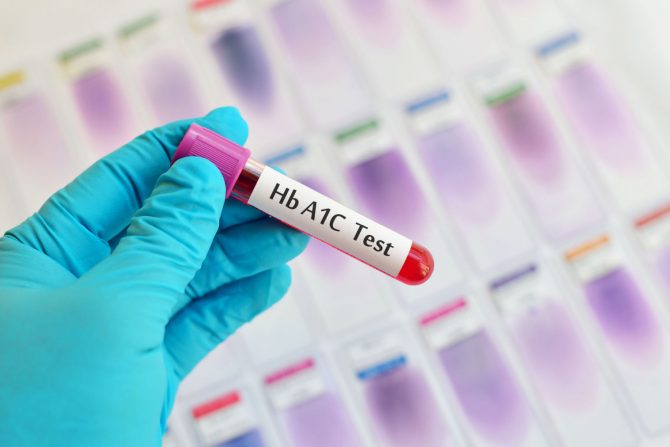 test hemoglobina A1c