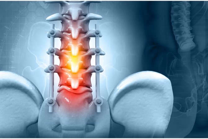 implantat kičmene moždine