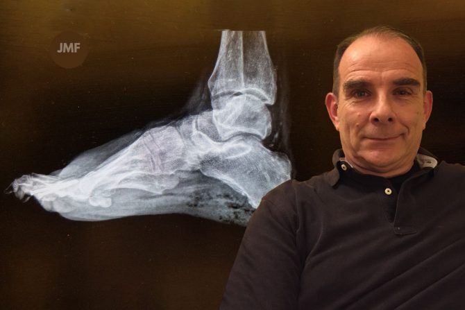 Gangrena Miodrag Ilić