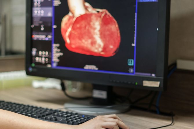 kompjuterizovana tomografska angiografija (CTA)