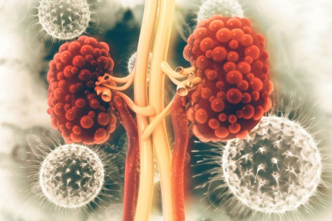 policistična bolest bubrega