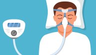 Opstruktivna sleep apnea: Terapija, modalititeti, nedoumice, pristup i dometi