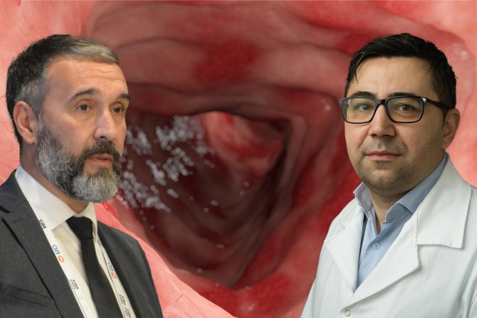 Zapaljenske bolesti creva