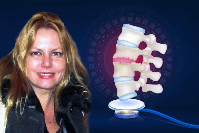 ankilozirajući spondilitis