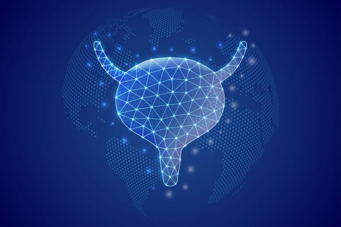 rak mokraćne bešike