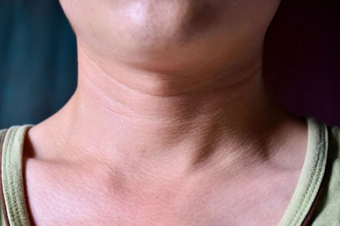Izrasline na vratu