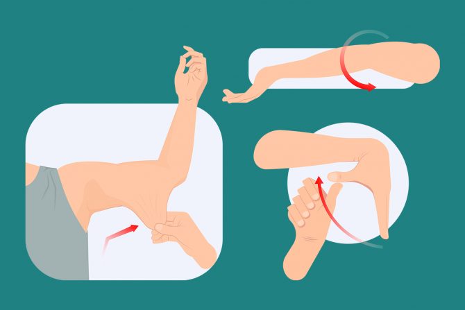 Ehler-Danlos sindrom