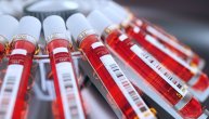 Šta otkriva test FT4 hormona ili test slobodnog tiroksina