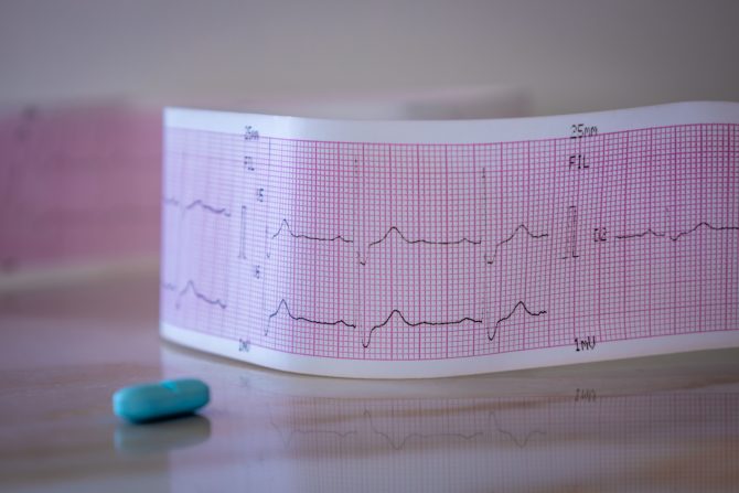 blok desne grane srca