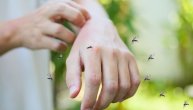 Ujedi insekata, kako da ih identifikujemo i kada da potražimo lekarsku pomoć
