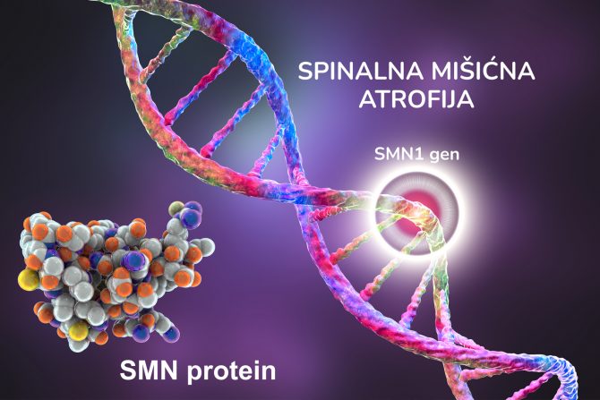 spinalna mišićna atrofija