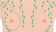 Promene na grudima – šta je normalno, a šta nije