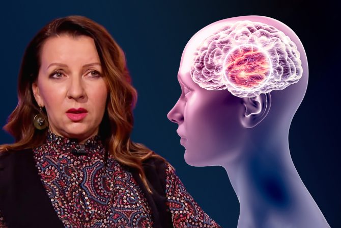 Blagi kognitivni poremećaj