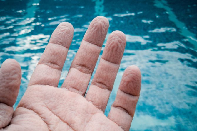 smežurani prsti od vode