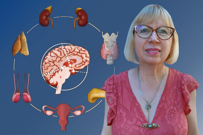 stres dr Vesna Dimitrijević Srećković