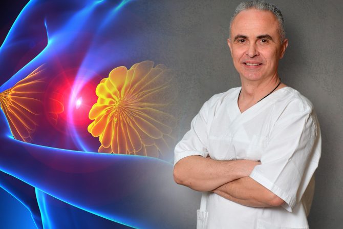 Intraduktalni papilom dojke