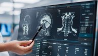 Kompjuterska tomografija ili CT – šta sve može da otkrije ovo snimanje