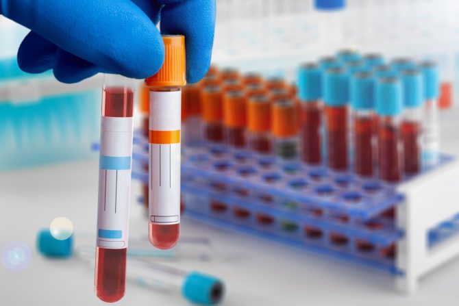 ispitivanje funkcije jetre