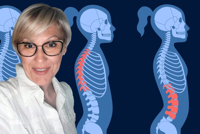 deformiteti kod dece