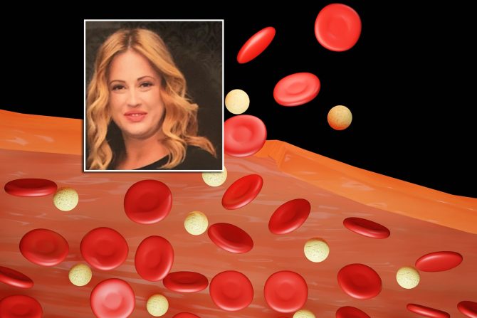 Hemofilija dr Danijela Leković