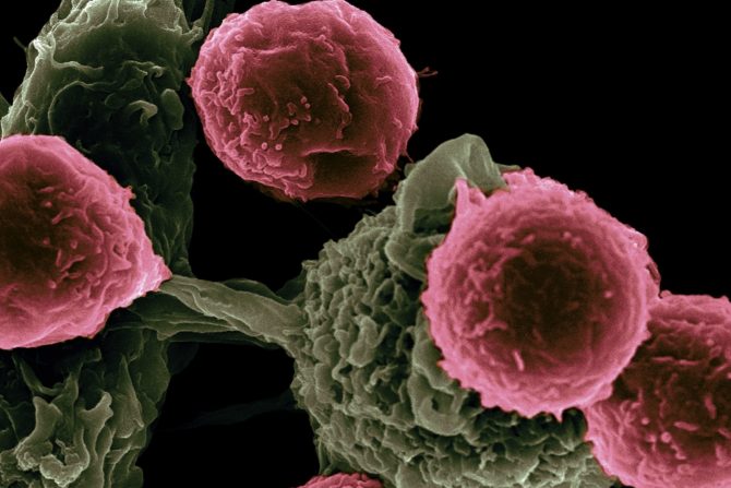 test za otkrivanje raka grlića materice