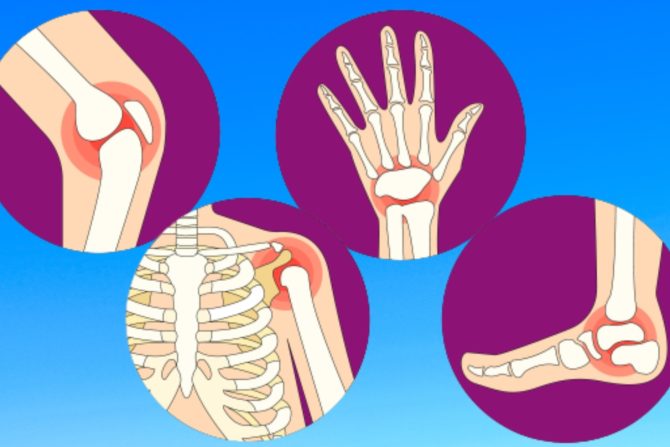 svetski dan fizioterapeuta