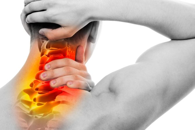 uklješten nerv u vratu