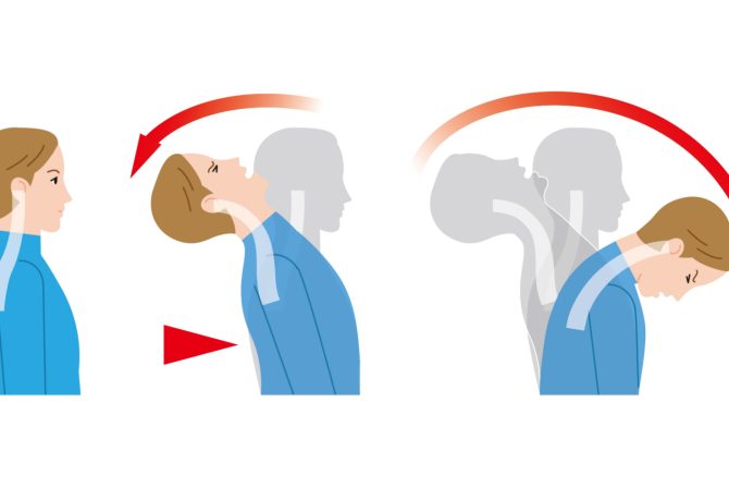 trzajna povreda vrata