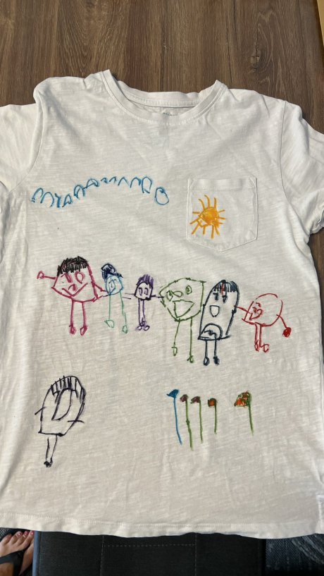 Daunov sindrom Luka crtež