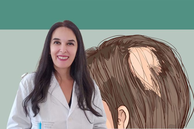 Alopecija Svetlana Popadić