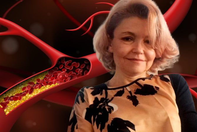 Loš holesterol prof dr Veroslava Stanković