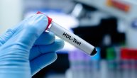 Nije važno samo koliki je HDL ili „dobar holesterol“ već i koliko dobro funkcioniše
