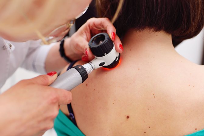 nemelanomski rak kože