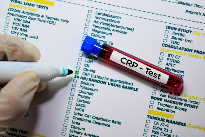 CRP vrednosti