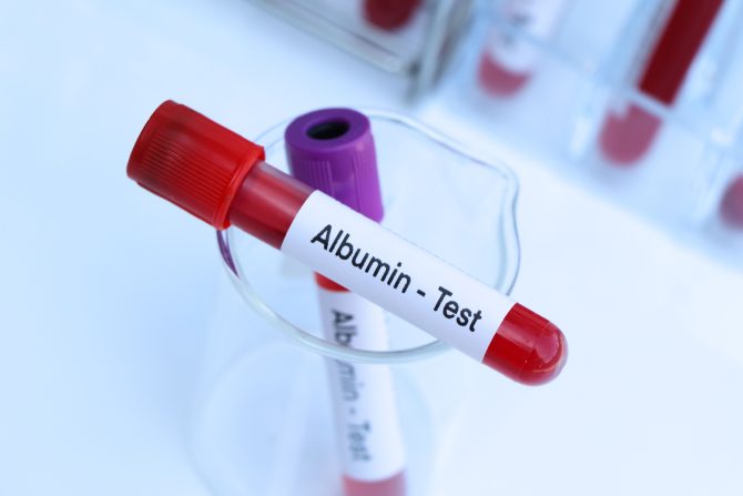 Albumini