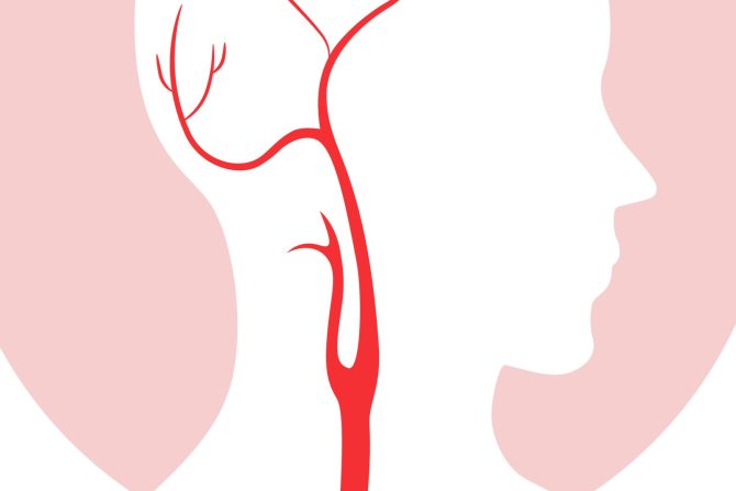 Nabrekle vene na vratu