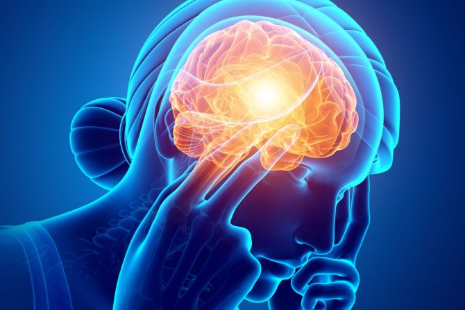 Paroksizmalna hemikranija