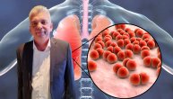 Od respiratorne infekcije do upale pluća: Pneumokok može da izazove meningitis, ali i sepsu
