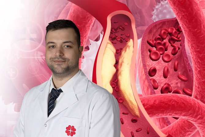 Bolest perifernih arterija