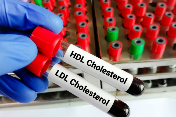 dobar i loš holesterol