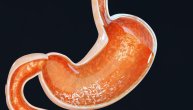 Autoimuni gastritis izaziva nedostatak jednog vitamina uz anemiju