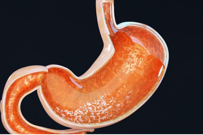 Autoimuni atrofični gastritis