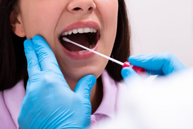 test pljuvačke za otkrivanje raka