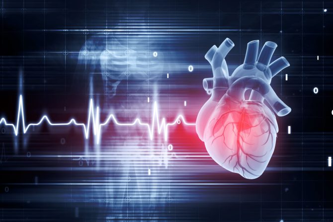 kardiovaskularne bolesti