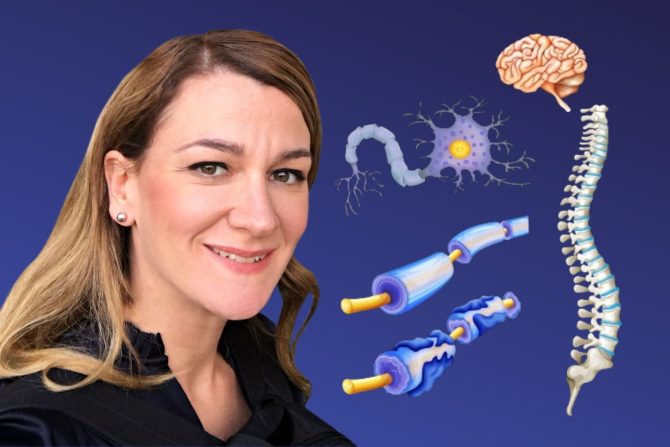 mogućnosti lečenja MS