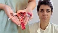 Koji simptomi mogu upozoriti na upalu bartolinijeve žlezde i kako se leči