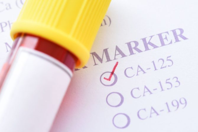 tumor marker CA 125