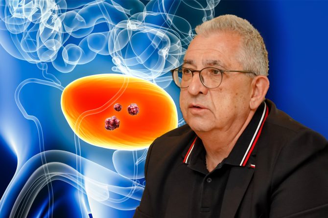 Karcinom mokraćne bešike prof.dr Zoran Džamić